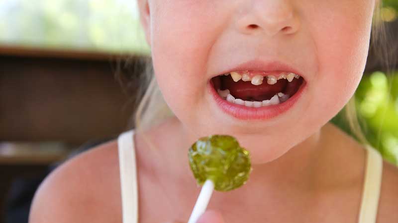 Causes for early childhood cavities