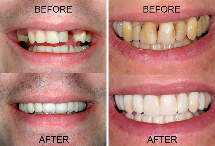 A smile makeover can have a significant impact on your life.